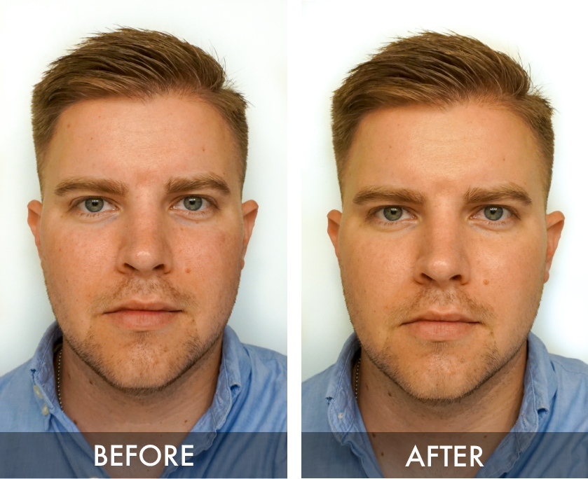 CC Cream Tinted Face Moisturizer for Men Before and After